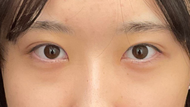 Postoperative Condition Part 1