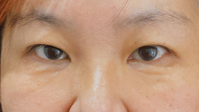 Postoperative Condition Part 1