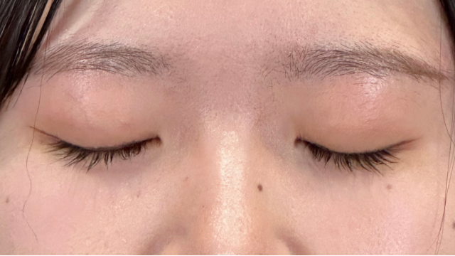 Postoperative Condition Part 1