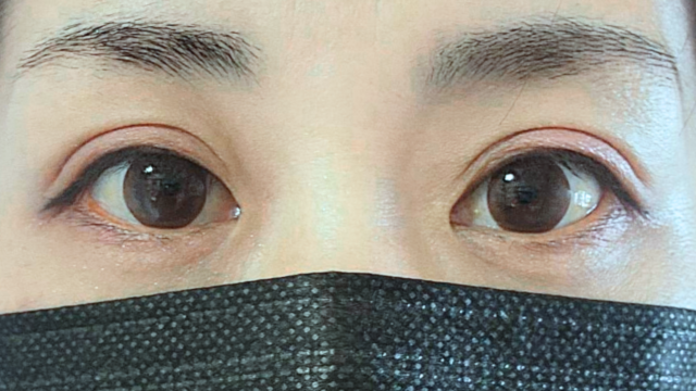 Postoperative Condition Part 1