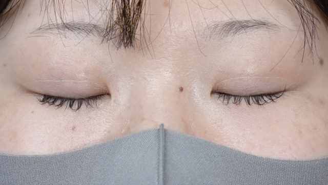 Postoperative Condition Part 1