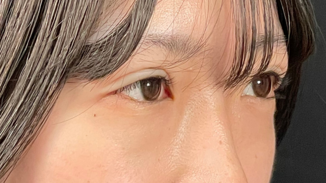 Postoperative Condition Part 1