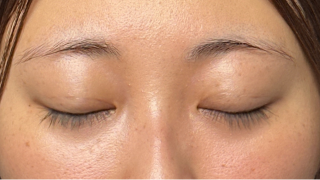 Postoperative Condition Part 1