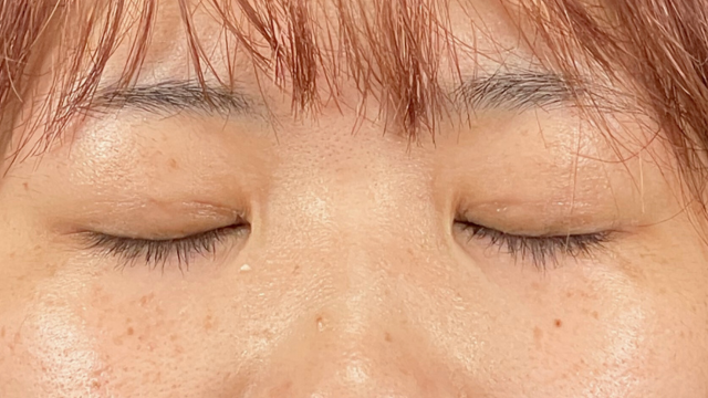 Postoperative Condition Part 1