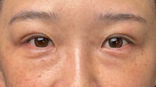 Postoperative Condition Part 1