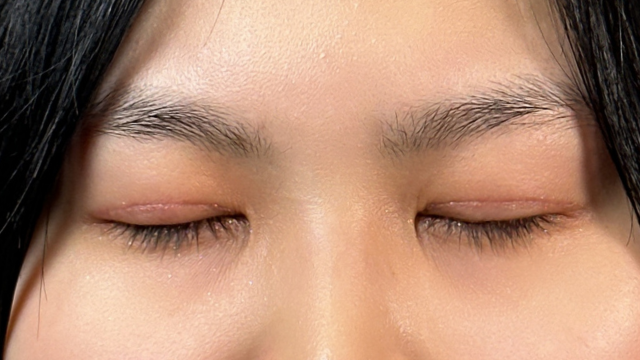 Postoperative Condition Part 1