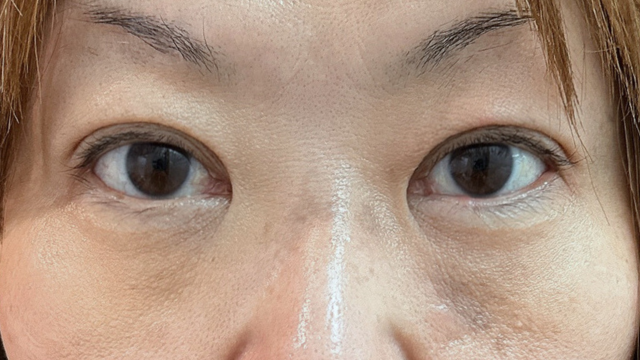 Postoperative Condition Part 1