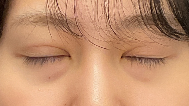 Postoperative Condition Part 1