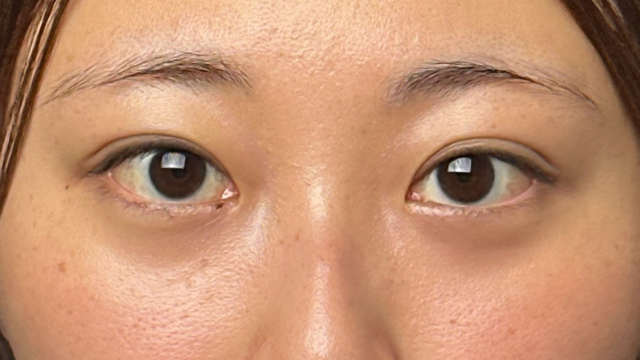 Postoperative Condition Part 1