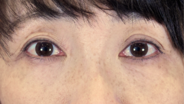 Postoperative Condition Part 1