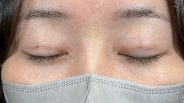 Postoperative Condition Part 1