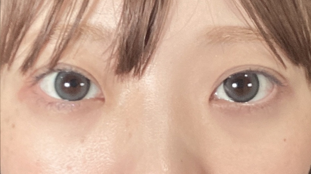 Postoperative Condition Part 1