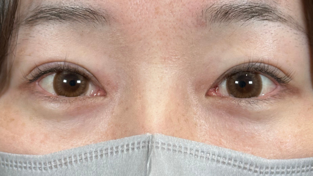 Postoperative Condition Part 1