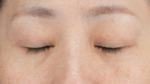 Postoperative Condition Part 1