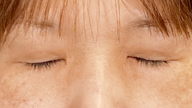 Postoperative Condition Part 1