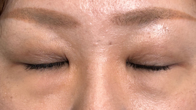 Postoperative Condition Part 1