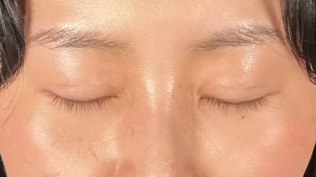 Postoperative Condition Part 1