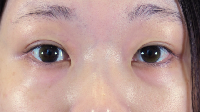 Postoperative Condition Part 1