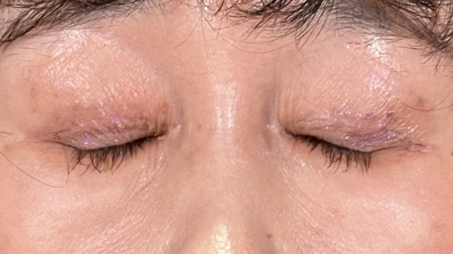 Postoperative Condition Part 1