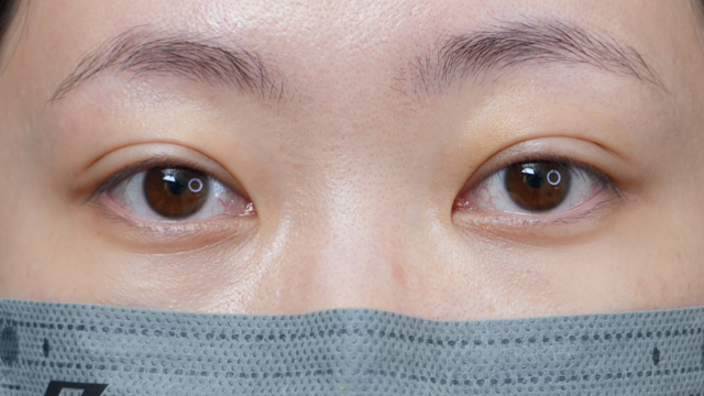 Postoperative Condition Part 1