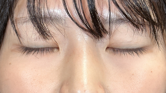 Postoperative Condition Part 1