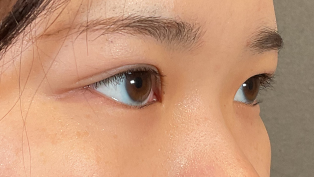 Postoperative Condition Part 1