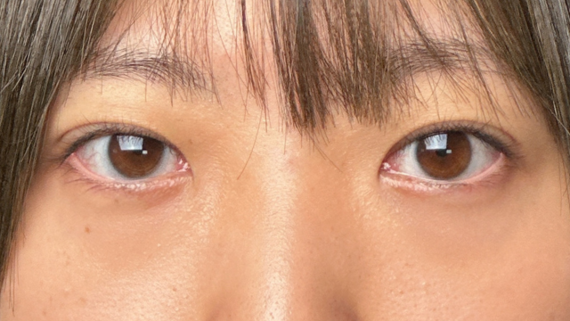 Postoperative Condition Part 1