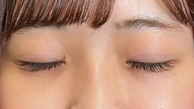 Postoperative Condition Part 1