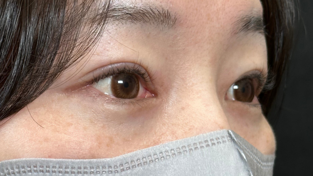 Postoperative Condition Part 1