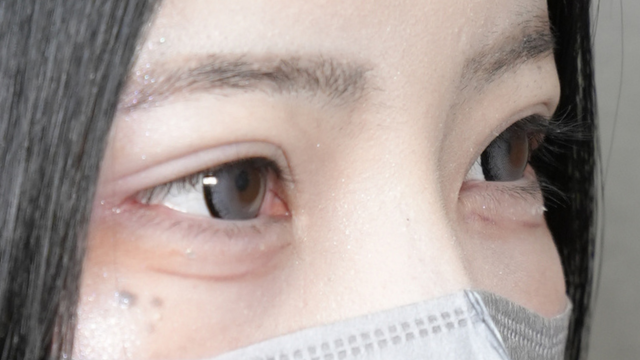 Postoperative Condition Part 1