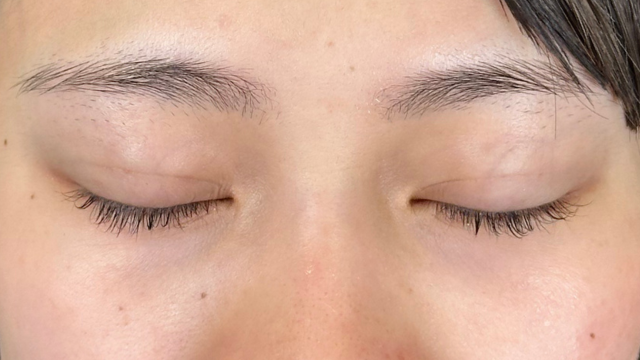 Postoperative Condition Part 1