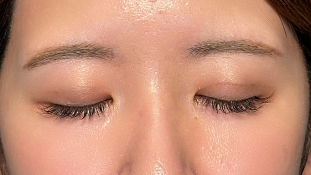 Postoperative Condition Part 1