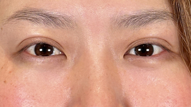 Postoperative Condition Part 1