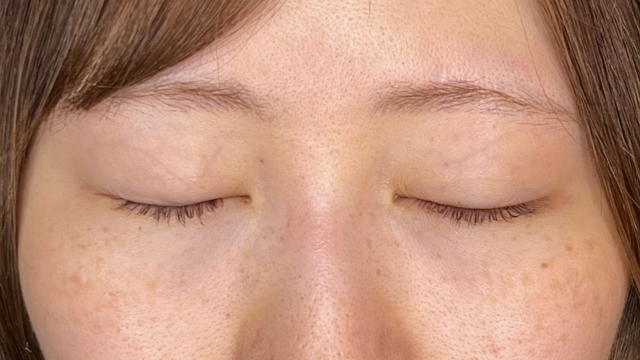 Postoperative Condition Part 1