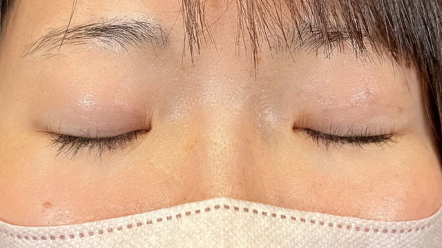 Postoperative Condition Part 1