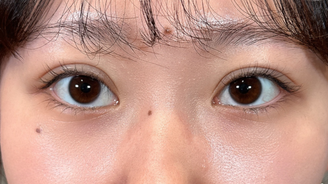 Postoperative Condition Part 1