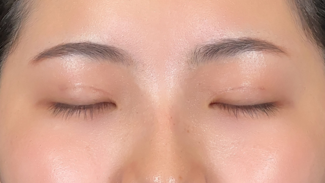 Postoperative Condition Part 1