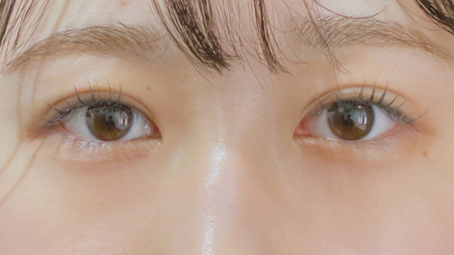 Postoperative Condition Part 1