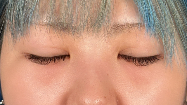 Postoperative Condition Part 1