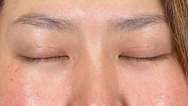 Postoperative Condition Part 1