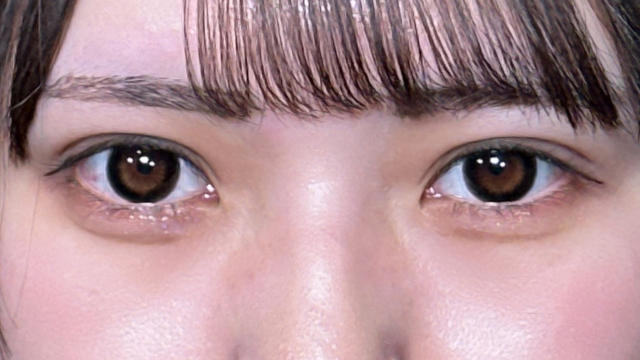 Postoperative Condition Part 1