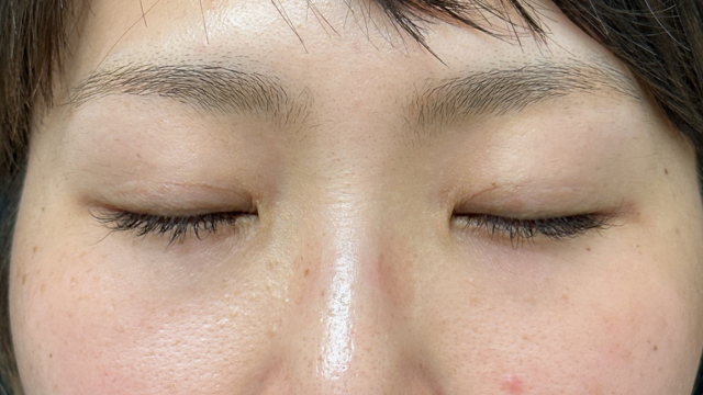 Postoperative Condition Part 1