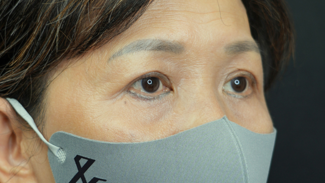 Postoperative Condition Part 1