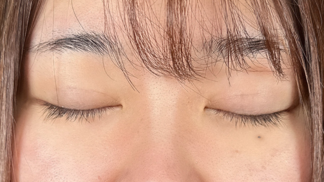 Postoperative Condition Part 1