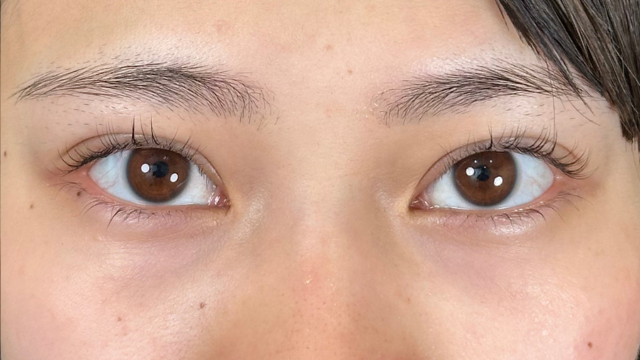 Postoperative Condition Part 1