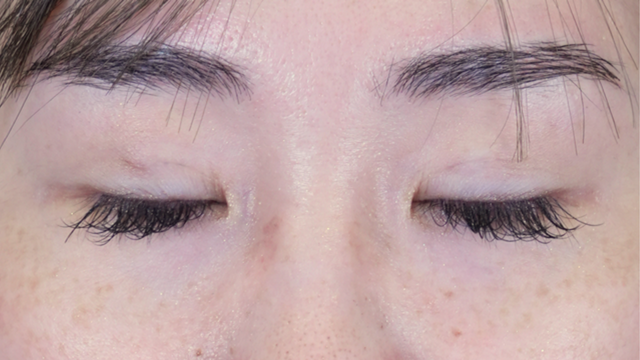 Postoperative Condition Part 1