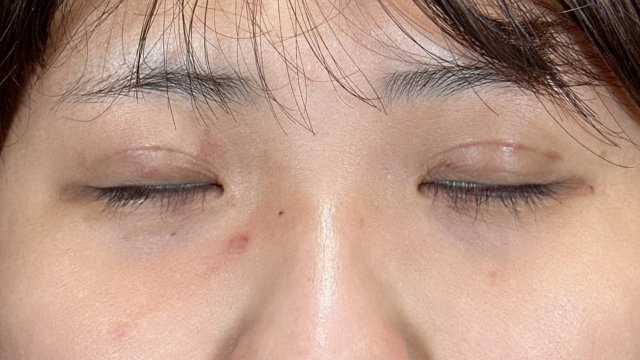 Postoperative Condition Part 1