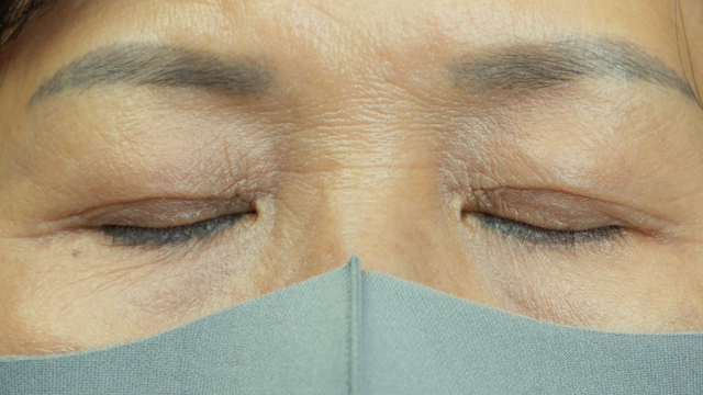 Postoperative Condition Part 1