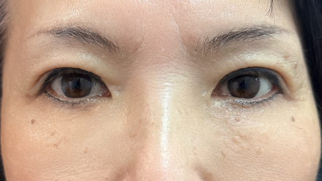 Postoperative Condition Part 1