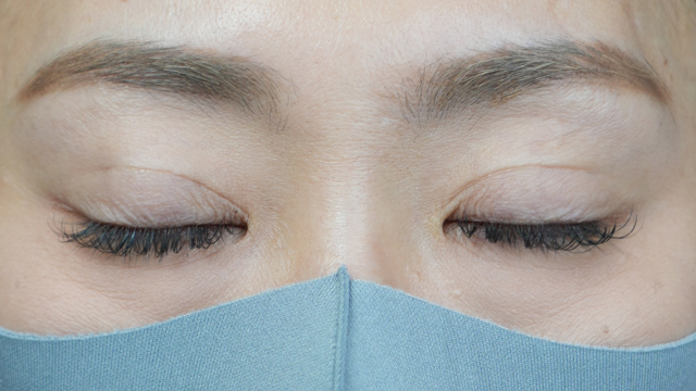 Postoperative Condition Part 1